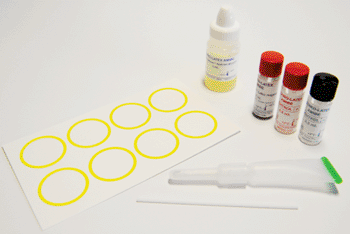 Imagen: Lámina de una prueba de aglutinación de látex coloreada, Bichrolatex-Amibe para el serodiagnóstico de la amebiasis  intestinal (Fotografía cortesía de Fumouze Diagnostic).